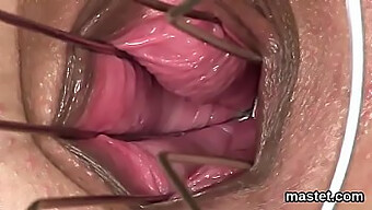 A Unique Czech Woman Expands Her Constricted Vagina With A Particular Instrument